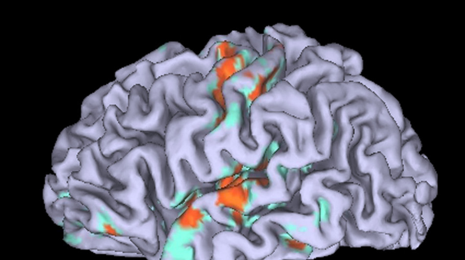 Trovata la regione del cervello che fa predicare bene e razzolare male
