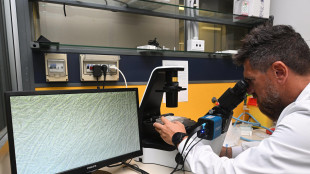 Svelato come la sclerosi multipla uccide i neuroni