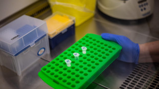 L'Ue invia all'Oms test Pcr sull'Ebola per 2,1 milioni di euro