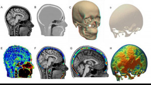 Dolore cronico da schiena a ginocchia, coinvolto il midollo osseo del cranio